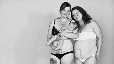 Valokuvaaja Anna Huovisen kuvasarja on ylistys erilaisille naiskehoille – arvet kertovat eletystä elämästä